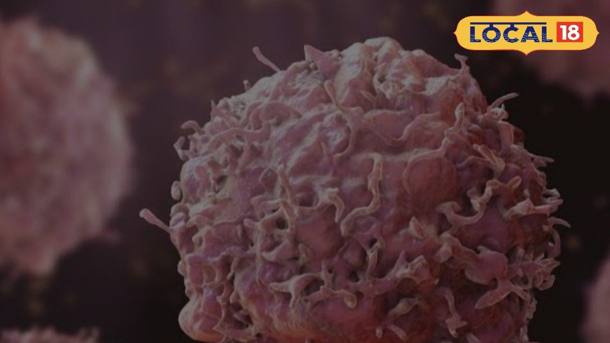 Health Tips: आनुवंशिकतेमुळे खरंच वाढतो का कॅन्सरचा धोका? कितपत आहे हे सत्य?  पाहा डॉक्टर काय सांगतात, Video