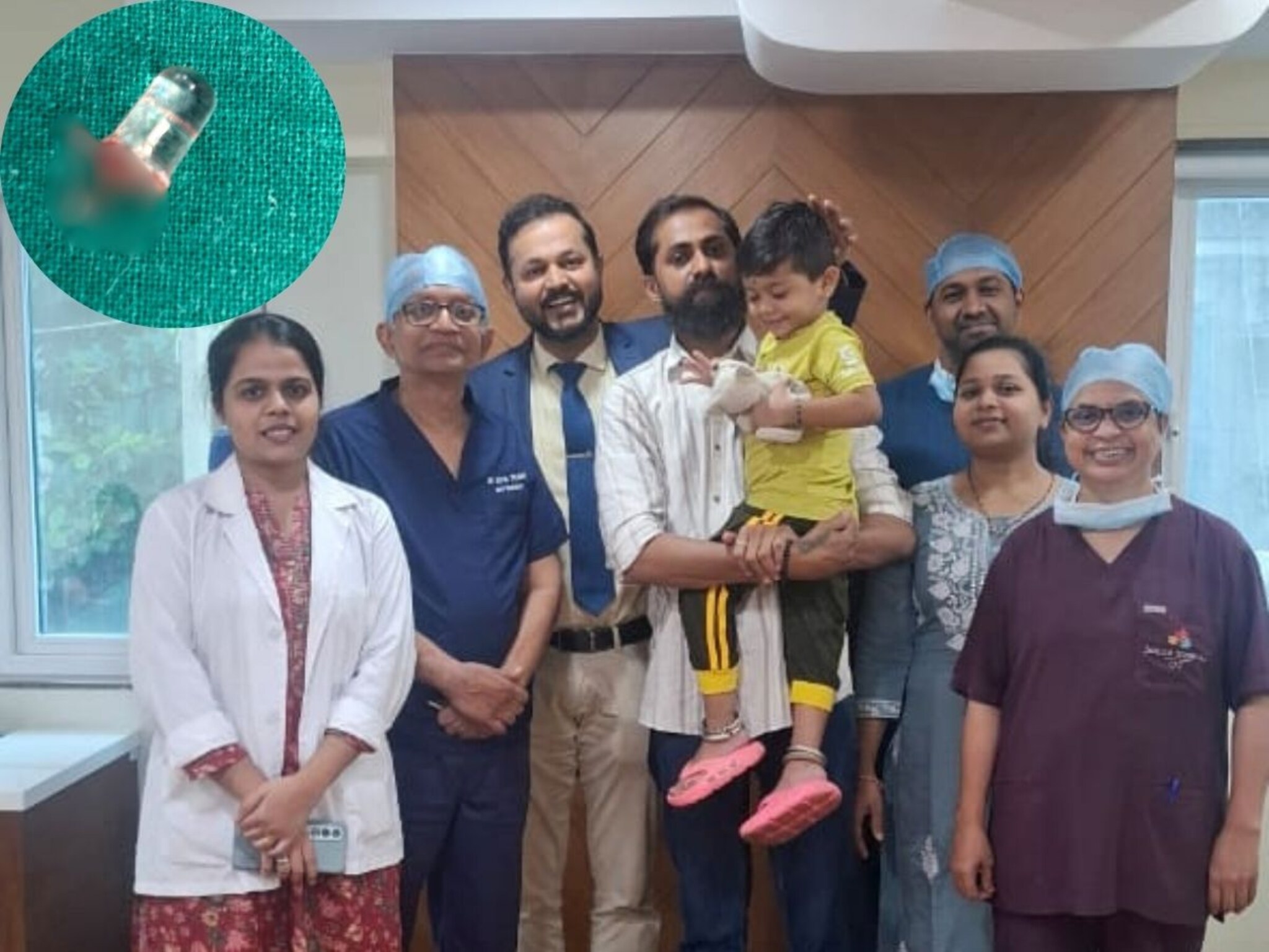 साडेतीन वर्षांच्या मुलाच्या फुफ्फुसातून बाहेर काढला LED बल्ब, धक्कादायक घटना