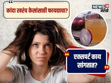 News18