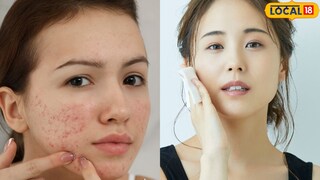 चेहऱ्यावरील तेज परत मिळवण्यासाठी उपाय.. 
