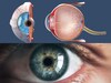 Retina Day : डोळ्यांविषयी या गोष्टी लक्षात ठेवा, संकेतांकडे दुर्लक्ष नको