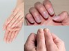 Nails : नखांचा रंग सांगतो तब्येतीचं अपडेट, अशी घ्या तब्येतीची काळजी