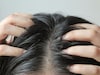 Oily Hair : या व्हिटॅमिनच्या कमतरतेमुळे केस होतात चिकट, जाणून घ्या उपाय