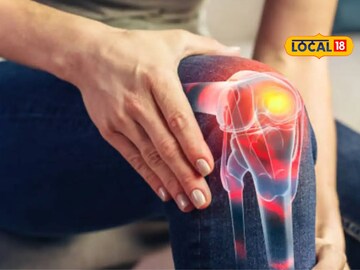 सतत हाडांचा त्रास? असू शकतो गंभीर आजाराचा धोका, अशी घ्या वेळीच काळजी