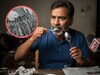 29 चमचे आणि 19 टूथब्रश गिळूनही तो जिवंत? X-ray पाहाताच डॉक्टरही हादरले