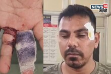 BJP Shiv Sena Clash : महापालिका निवडणुकीआधीच ठिणगी पडली,  शिवसेना-भाजप कार्यकर्त्यांमध्ये राडा,  3 जण जखमी