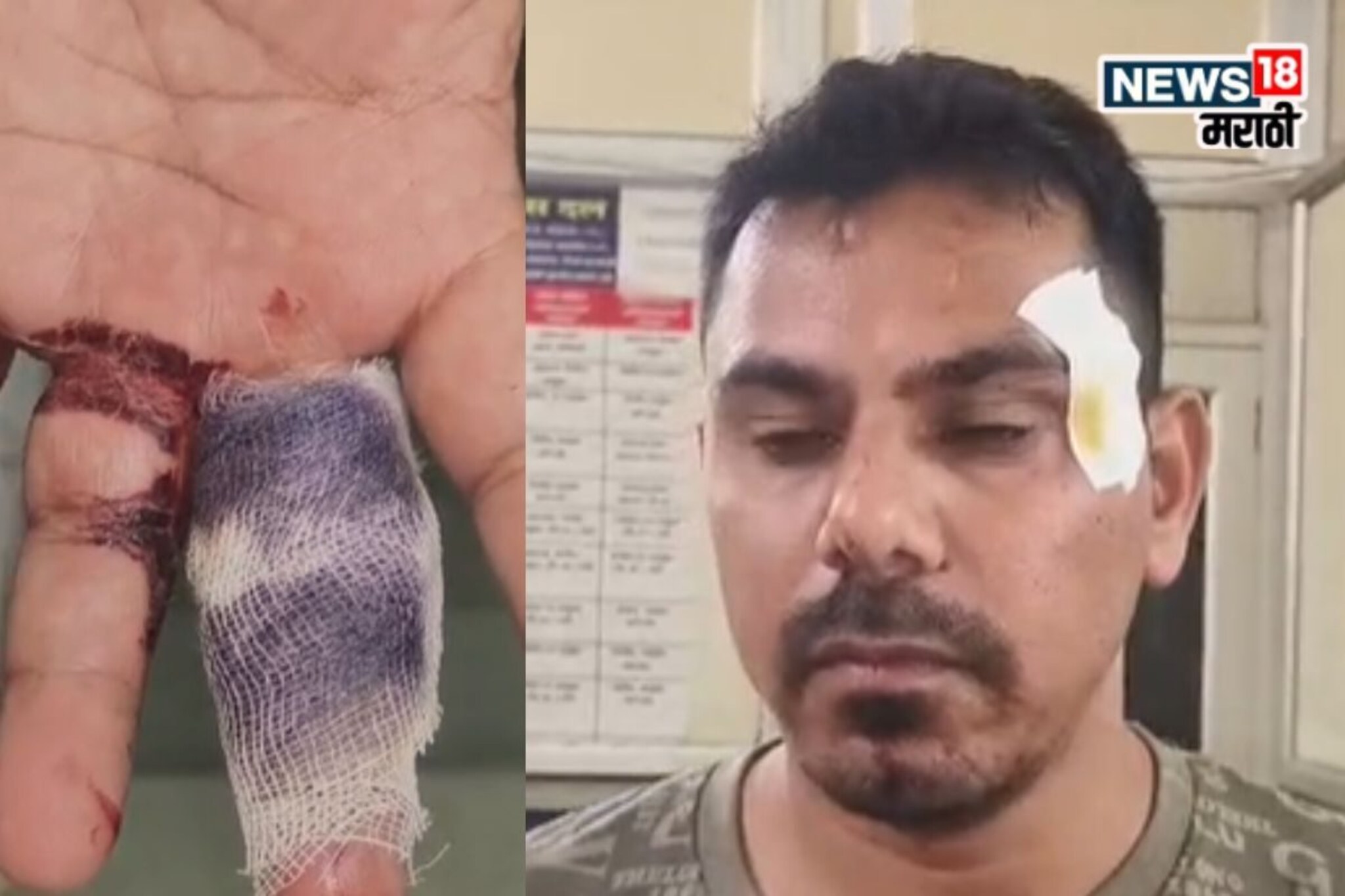 निवडणुकीआधीच ठिणगी पडली,  शिवसेना-भाजप कार्यकर्त्यांमध्ये राडा, 3 जण जखमी