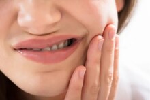 ब्रश नाही केला तर... एका दिवसातच दाताची अशी अवस्था, वर्षभरात मृत्यूचा धोका