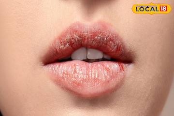 थंडीत तुमच्या गोड ओठांची अशी घ्या काळजी, केमिकलऐवजी वापरा 'हा' DIY लिप बाम थंडीत तुमच्या गोड ओठांची अशी घ्या काळजी, केमिकलऐवजी वापरा 'हा' DIY लिप बाम