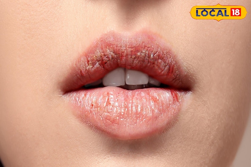 हिवाळ्यात ओठ फाटण्यापासून रोखण्याचा सर्वात सोपा आणि सुरक्षित मार्ग म्हणजे घरी नैसर्गिक लिप बाम बनवणे. हे केवळ स्वस्तच नाही तर तुमच्या त्वचेसाठी अविश्वसनीयपणे निरोगी देखील असते. दररोज याचा वापर केल्याने तुमचे ओठ सुंदर आणि मऊ राहतील. हिवाळ्यात ओठ फाटण्यापासून रोखण्याचा सर्वात सोपा आणि सुरक्षित मार्ग म्हणजे घरी नैसर्गिक लिप बाम बनवणे. हे केवळ स्वस्तच नाही तर तुमच्या त्वचेसाठी अविश्वसनीयपणे निरोगी देखील असते. दररोज याचा वापर केल्याने तुमचे ओठ सुंदर आणि मऊ राहतील.