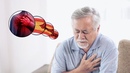 Heart Disease Heart Disease