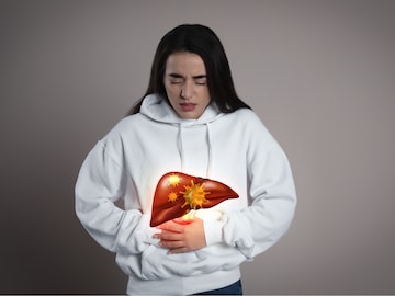 Liver Cirrhosis