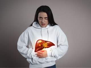 Liver Cirrhosis Liver Cirrhosis