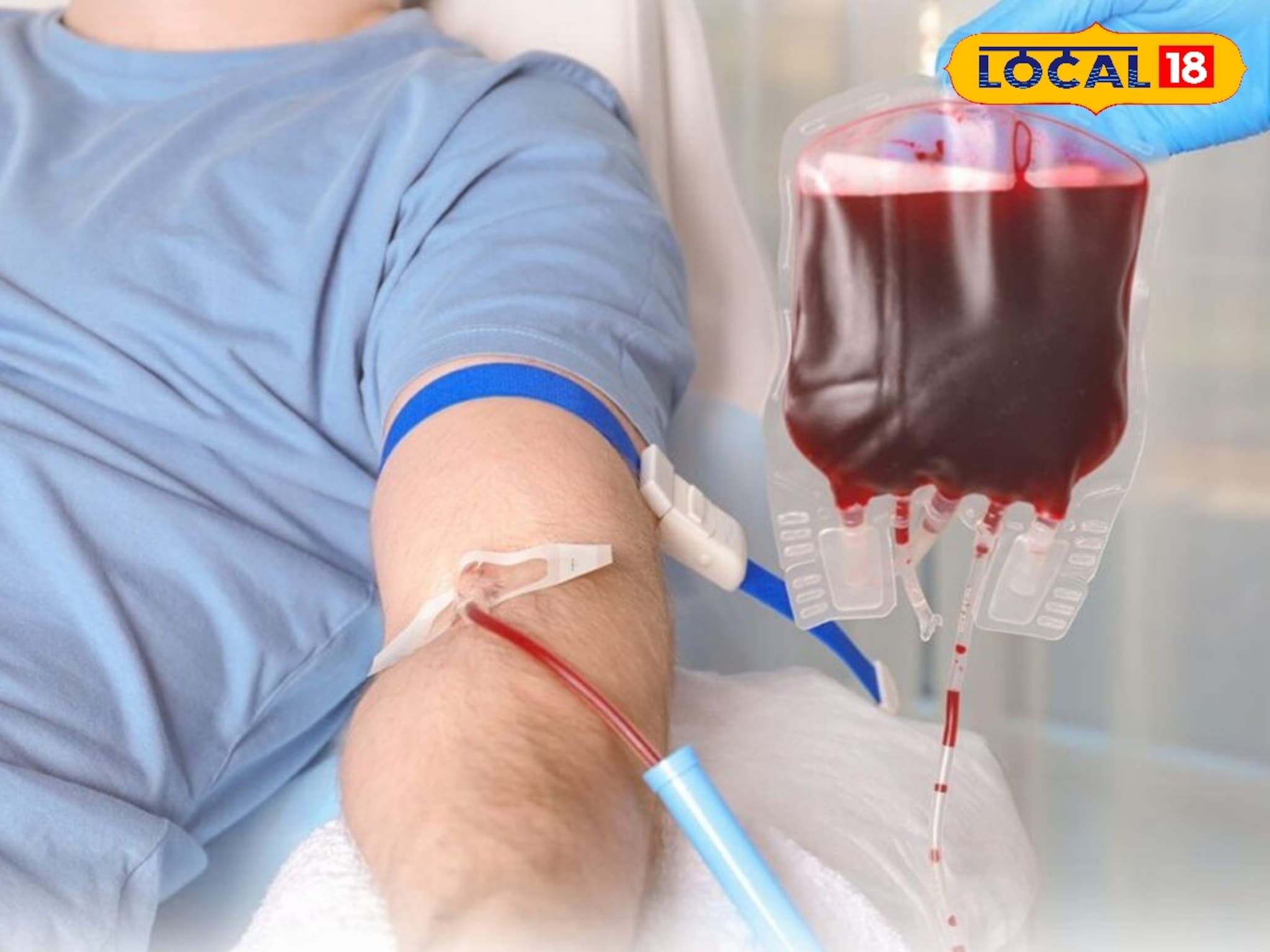 पुण्यात उत्सवाचा जल्लोष जीवावर बेतणार? अपघातातील जखमींना रक्त मिळेना