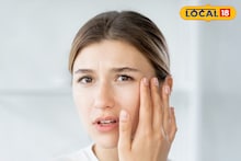 Health Tips : संपूर्ण शरीराची त्वचा कोरडी पडतेय? काय उपाय करावा? डॉक्टरांनी सांगितल्या महत्त्वाच्या टिप्स