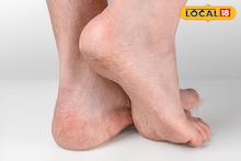 Health Tips : हिवाळ्यात तळपायाला भेगा पडतात? हा सोपा उपाय करून बघा, तळपाय राहील मुलायम