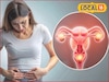  PCOD आजाराचा वाढता धोका, महिलांनी काय घ्यावी काळजी? डॉक्टरांनी सांगितला सोपा उपाय