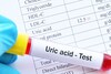 Uric Acid : युरिक अ‍ॅसिड वाढल्याचा त्वचेवरही जाणवतो परिणाम, ही आहेत लक्षणं