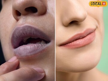 चहा-कॉफी प्यायल्याने ओठ काळे पडतात का?