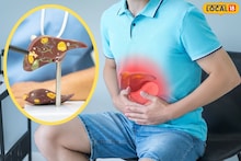 Health Tips : फॅटी लिव्हरवर उत्तम उपाय; 'हे' 3 सुपरफूड्स लिव्हर ठेवतात स्वच्छ, निरोगी आणि तंदुरुस्त!
