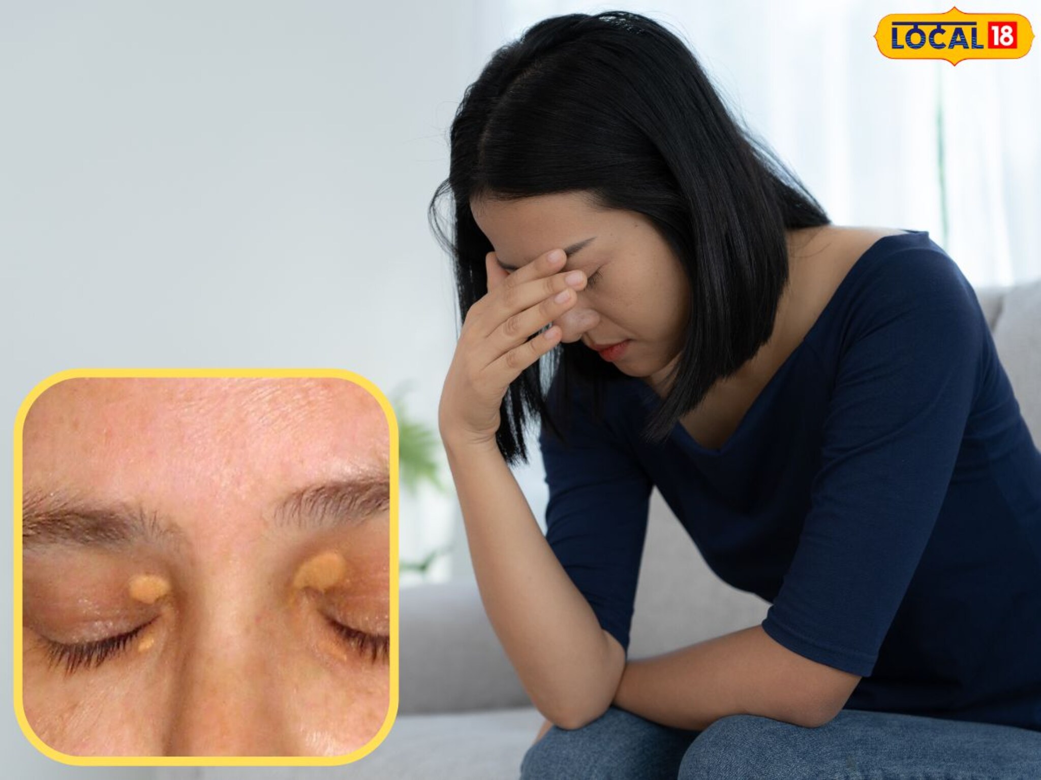 Health Tips : डोळ्यांवर पांढऱ्या खुणा दिसतायत? सावधान! तुमचं आरोग्य आहे धोक्यात, वेळीच घ्या काळजी