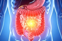 Intestines : आतडी स्वच्छ ठेवण्यासाठी या गोष्टी लक्षात ठेवा, पचन होईल व्यवस्थित, तब्येत राहिल निरोगी