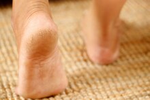 Cracked Heels : तळव्यांना भेगा का पडतात ? टाचांसाठी कोणते उपाय करायचे ?