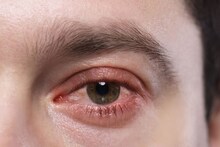 Eye Care : वायू प्रदूषणापासून डोळ्यांना जपा, डोळ्यांच्या रक्षणासाठी या टिप्स ठरतील उपयु्क्त