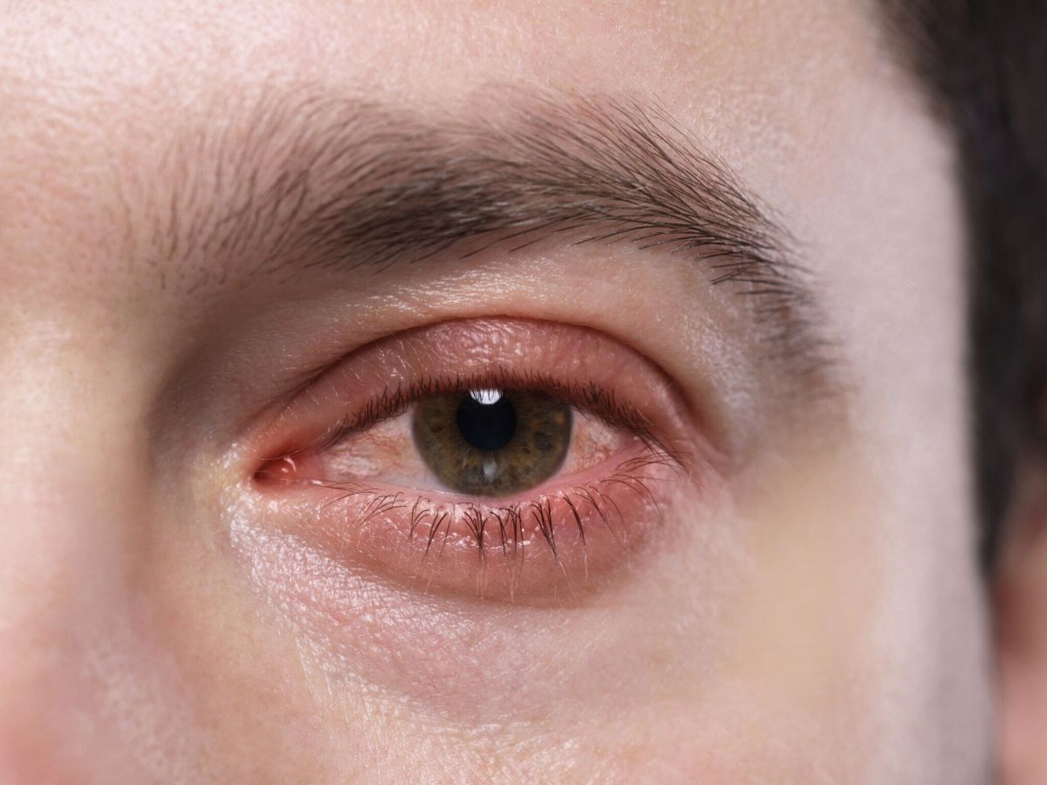 Eye Care : वायू प्रदूषणापासून डोळ्यांना जपा, डोळ्यांच्या रक्षणासाठी या टिप्स ठरतील उपयु्क्त