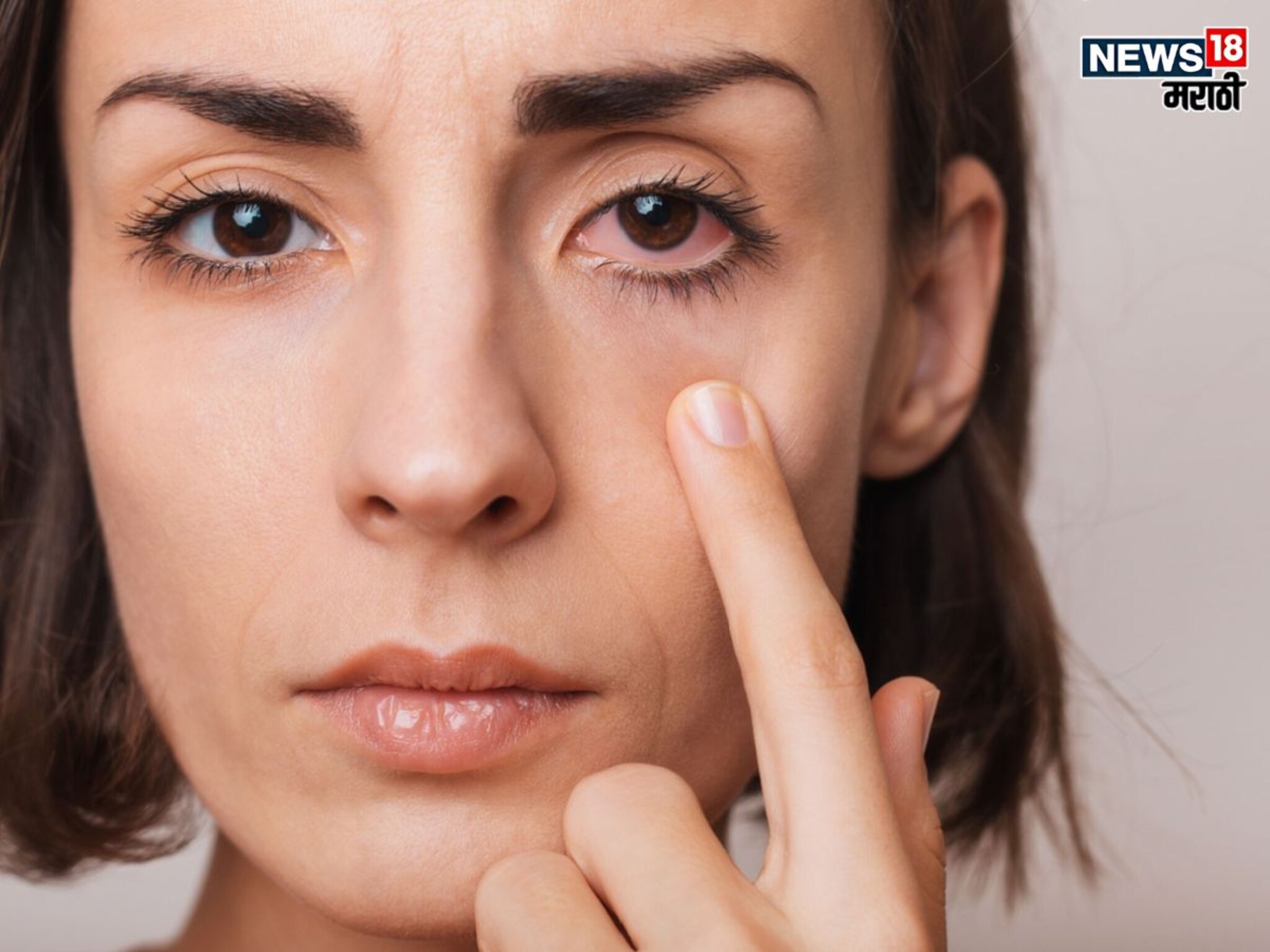 Health : 'ही' लाल भाजी सुधारते दृष्टी पण… कोणी खाऊ नये, काय आहे नुकसान? वाचा सविस्तर