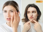 वारंवार चेहऱ्याला हात लावता? ही सवय पडेल महाग, 'या' गंभीर आजाराचा वाढेल धोका
