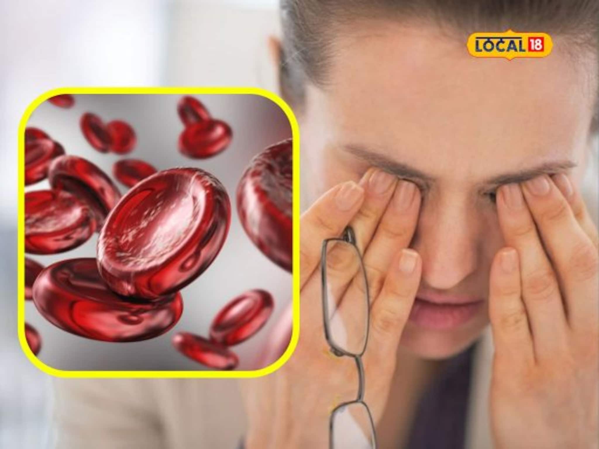 हिमोग्लोबीन कमी झालंय? ‘या’ पदार्थांचा आहारात तातडीनं समावेश करण्याचा तज्ज्ञांनी दिला सल्ला