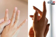 Cancer : बोटं आणि नखांमध्ये दिसतात कॅन्सरची लक्षणं, चुकूनही करू नका इग्नोर; नाही तर जाऊ शकतो जीव