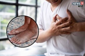 पायांमध्ये दिसत हार्ट अटॅकच 1 लक्षण, 99% लोक करतात इग्नोर