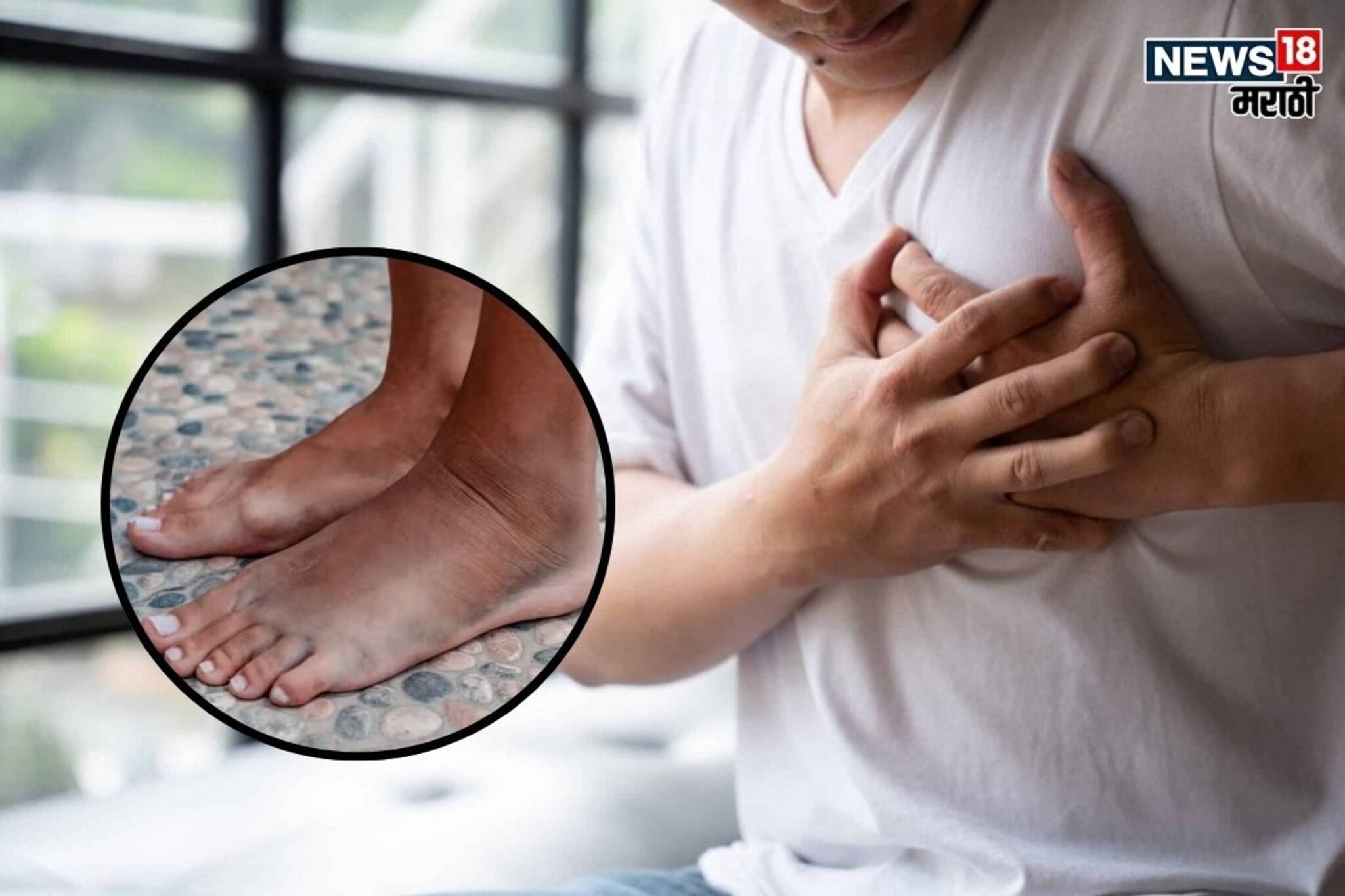 पायांमध्ये दिसत हार्ट अटॅकच 1 लक्षण, 99% लोक करतात इग्नोर