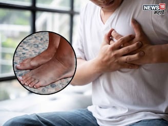 पायांमध्ये दिसत हार्ट अटॅकच 1 लक्षण, 99% लोक करतात इग्नोर