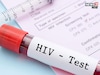 कसा वाढतो HIV चा धोका, स्टेज बाय स्टेज दिसू लागतात भयानक लक्षणं