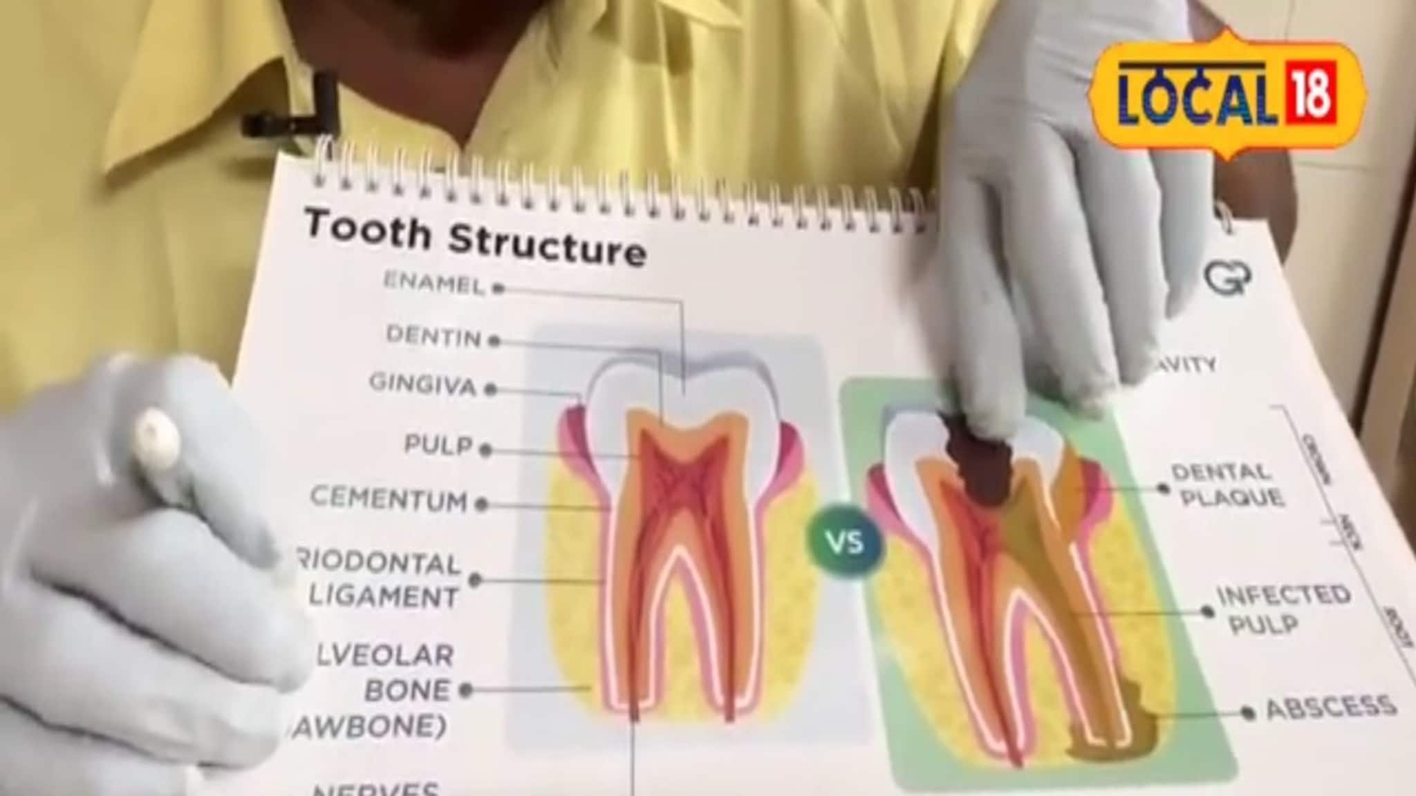 सणानिमित्त गोड पदार्थ खात असाल तर दातांना होईल त्रास, नेमकी काय काळजी घ्यावी?
