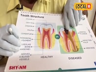 सणानिमित्त गोड पदार्थ खात असाल तर दातांना होईल त्रास, नेमकी काय काळजी घ्यावी?