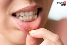 HIV Symptoms : शरीरात जाणवणारे 'हे' बदल, असू शकतात HIV चे लक्षण, जीवघेणे ठरण्याआधी ओळखा