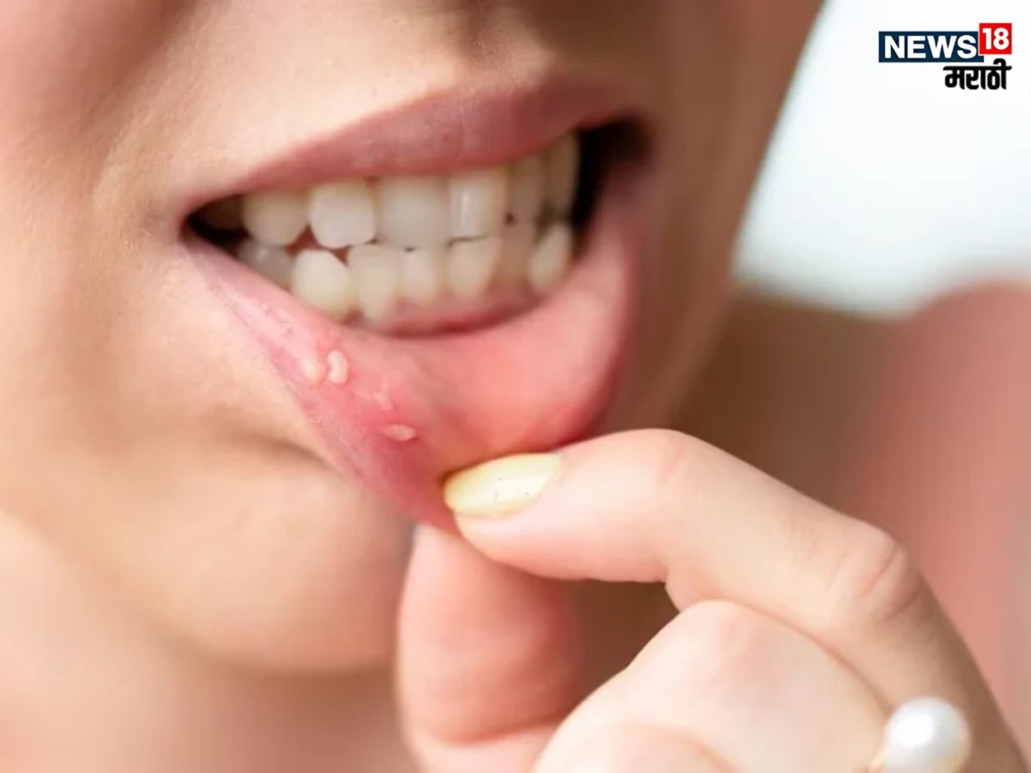 HIV Symptoms : शरीरात जाणवणारे 'हे' बदल, असू शकतात HIV चे लक्षण, जीवघेणे ठरण्याआधी ओळखा