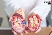 Kidney Health : रोजच्या जेवणातील 'हा' पदार्थ करू शकतो किडनी फेल, तुम्हीही खात नाही ना सफेद विष?