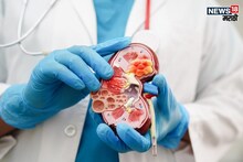 Kidney : एका किडनीवर किती काळ जिवंत राहू शकतो व्यक्ती, काय होतो शरीरावर परिणाम?