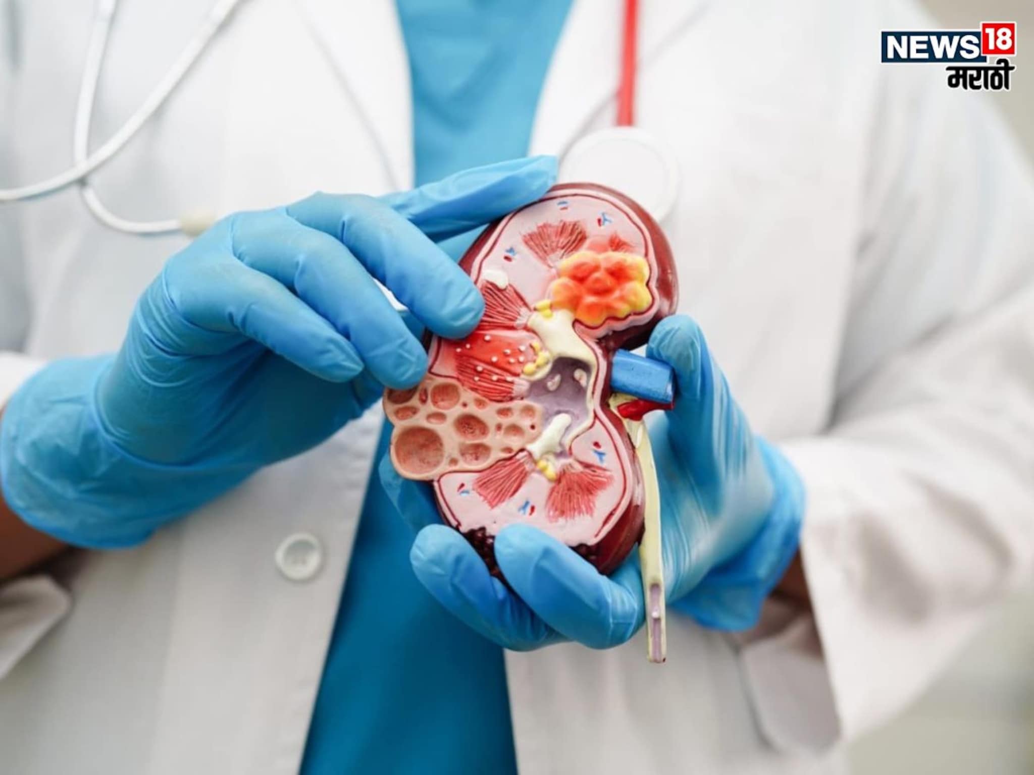 Kidney : एका किडनीवर किती काळ जिवंत राहू शकतो व्यक्ती, काय होतो शरीरावर परिणाम?