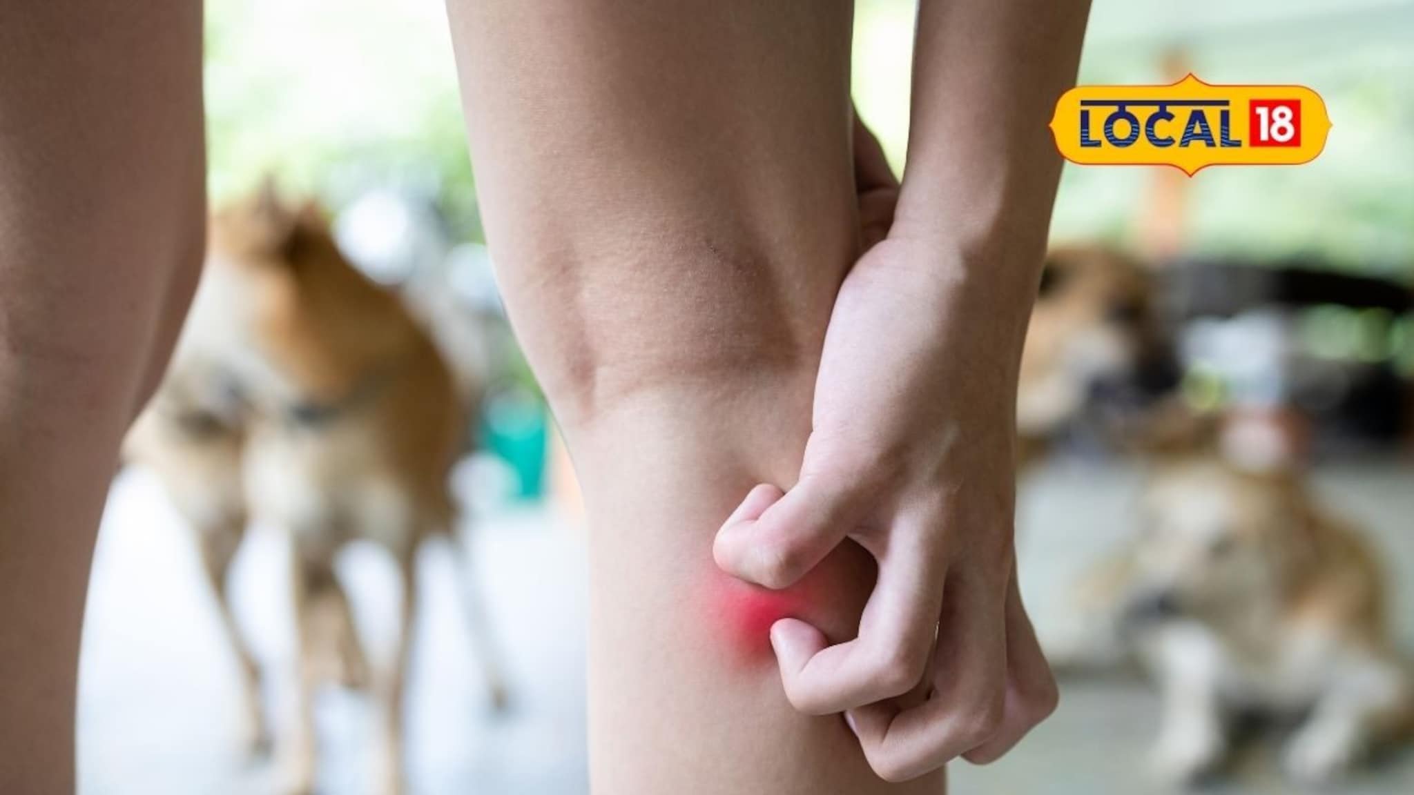 Dog Attack: अंगाला खाज, पाण्याची भीती; खतरनाक व्हायरसने चिमुकल्याचा मृत्यू, छ. संभाजीनगरमध्ये खळबळ