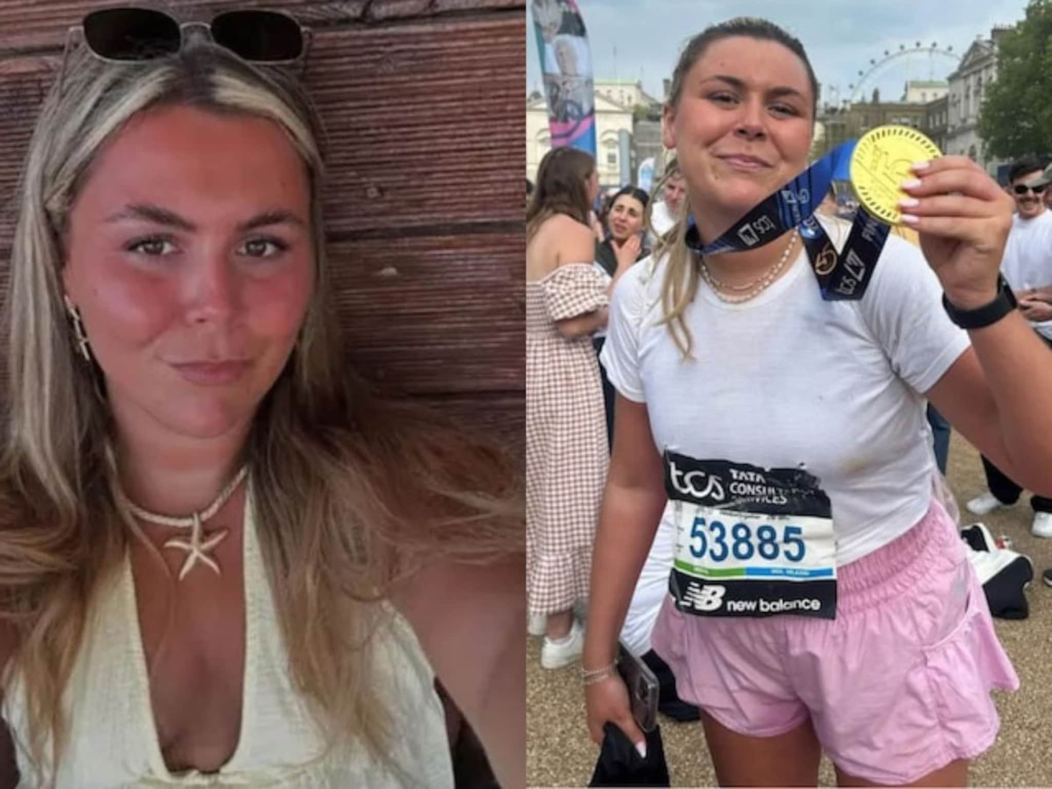 पूर्ण फिट होती तरुणी, अचानक शरिरावर आली सूज, पुढच्या काही तासात मृत्यूने गाठलं!