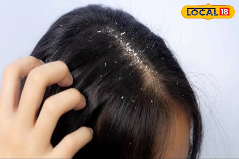 हिवाळ्यात, हेअर स्ट्रेटनर, कर्लर्स किंवा ड्रायर सारखी साधने तुमच्या केसांमधील ओलावा शोषून घेतात, ज्यामुळे केस तुटणे वाढते. त्यांचा वापर मर्यादित करा आणि तुटणे टाळण्यासाठी तुमचे केस नैसर्गिकरित्या स्टाईल करण्याचा प्रयत्न करा.