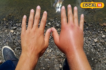 थंडीमुळे हात-पाय सुजतात? वेदना आणि सूज त्वरित दूर करतील हे सोपे घरगुती उपाय! थंडीमुळे हात-पाय सुजतात? वेदना आणि सूज त्वरित दूर करतील हे सोपे घरगुती उपाय!