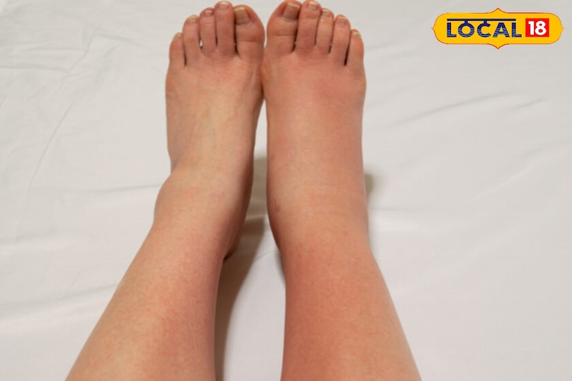 हिवाळ्यात तुमचे हात आणि पाय सुजले असतील तर घरी मोहरीच्या तेलाने हलकेच मालिश करा. रोज रात्री झोपण्यापूर्वी मोहरी किंवा तिळाच्या तेलाने असे केल्याने रक्ताभिसरण सुधारते आणि सूज कमी होते.