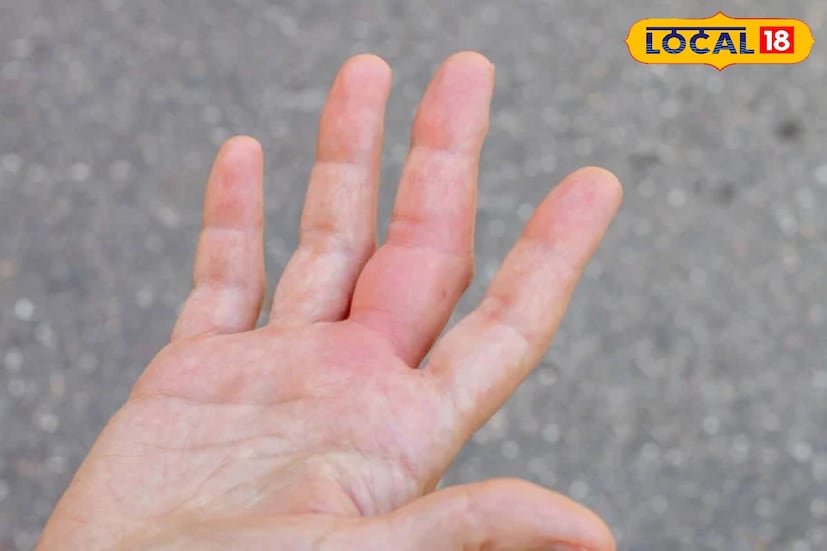 हिवाळ्यात, कॉम्प्रेस बनवा किंवा सेलरीचे पाणी प्या. कारण सेलरीचा तापमानवाढीचा प्रभाव असतो, ज्यामुळे अंतर्गत उष्णता मिळते. सेलरी पाण्यात उकळा आणि हे पाणी कॉम्प्रेससाठी वापरा किंवा कोमट प्या. यामुळे शरीरातील गॅस आणि पाण्याची धारणा दूर होण्यास मदत होते.